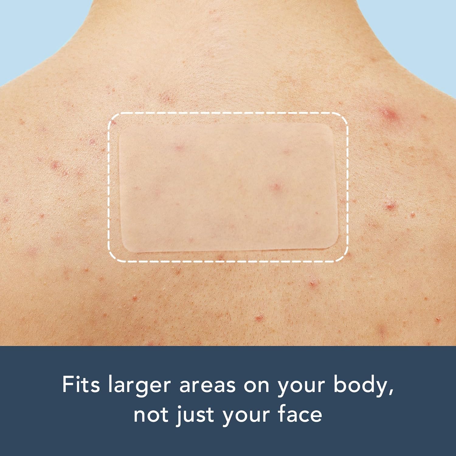 15 patchs d'acné longs de gran - Body Oil avis et prix